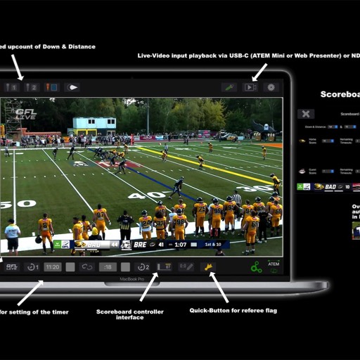 LS-Telestrator-controls